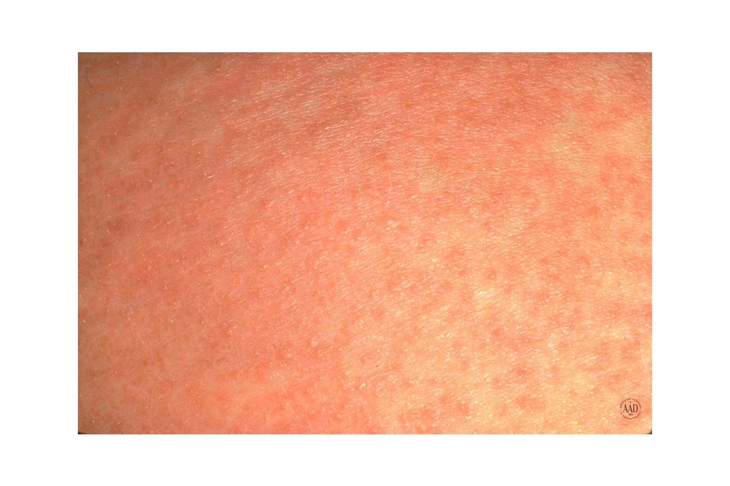 芙莉欧莎：疯狂的麦克斯传奇海报
